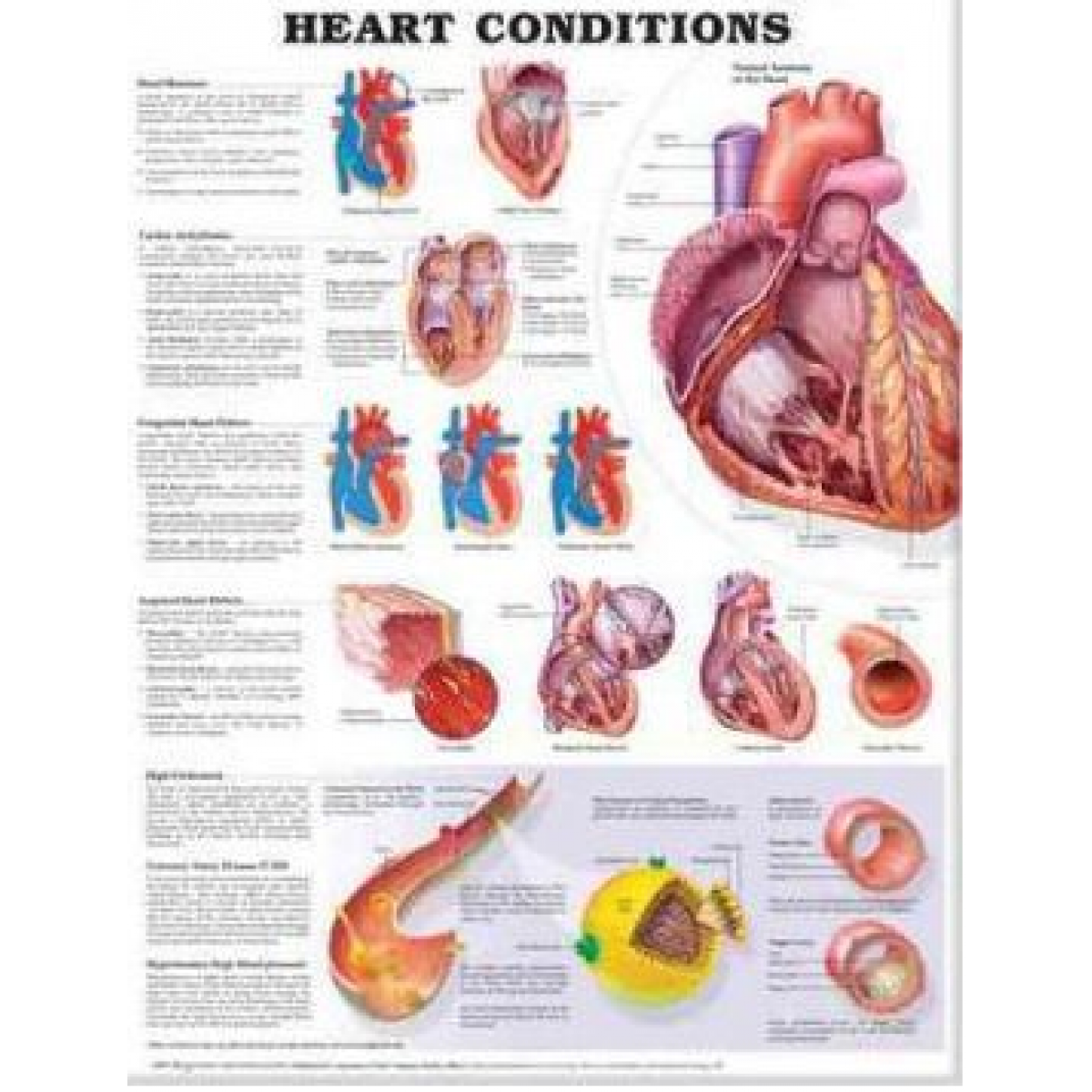 Anatomical Chart Company Heart Conditions School Locker