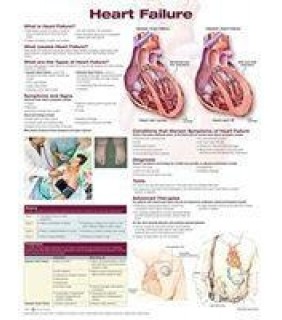 Anatomical Chart Company Heart Failure