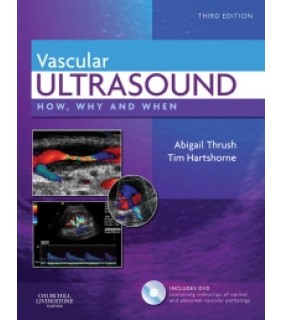 Churchill Livingstone ebook Vascular Ultrasound