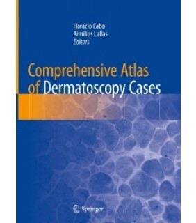 Springer ebook Comprehensive Atlas of Dermatoscopy Cases