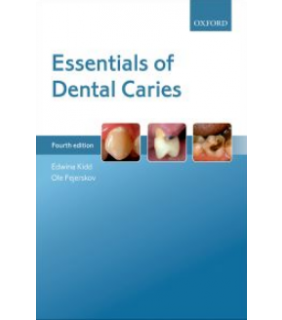 Oxford University Press UK ebook RENTAL 1YR Essentials of Dental Caries