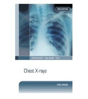 McGraw-Hill Education Australia ebook Pocket Guide to Chest X-Rays, Second Edition
