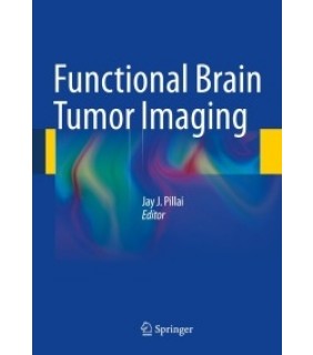 Springer ebook Functional Brain Tumor Imaging