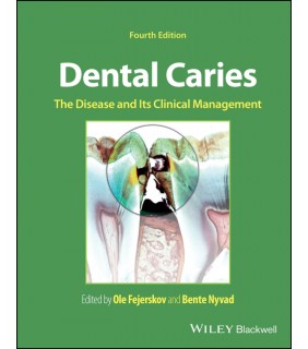 John Wiley & Sons ebook Dental Caries 4E: The Disease and its Clinical Managem