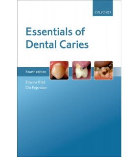 Oxford University Press Essentials of Dental Caries