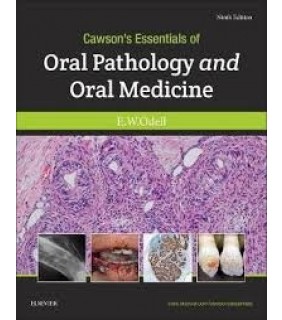 Cawson's Essentials of Oral Pathology and Oral Medicine