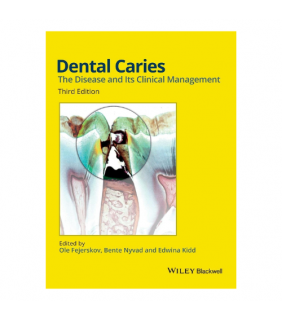 John Wiley & Sons ebook Dental Caries 3E: The Disease and its Clinical Management
