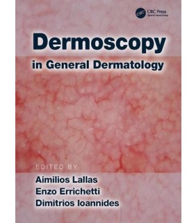 CRC Press ebook Dermoscopy in General Dermatology