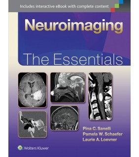 Lippincott Williams & Wilkins USA Neuroimaging: The Essentials