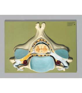 Anatomical Chart Company Fifth Cervical Vertebra