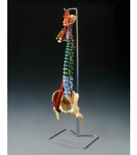 Anatomical Chart Company Muscle Spine With Disorders with Stand