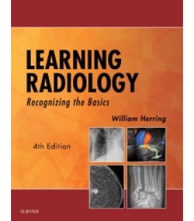 Elsevier Australia ebook Learning Radiology