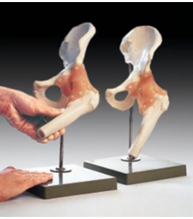 Anatomical Chart Company Functional Model of the Hip Joint