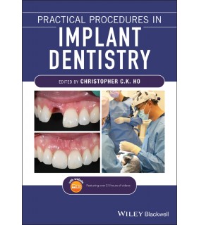 John Wiley & Sons Practical Procedures in Implant Dentistry