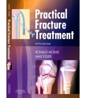 Churchill Livingstone ebook Practical Fracture Treatment