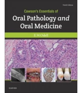 Elsevier ebook Cawson's Essentials of Oral Pathology and Oral Medicin