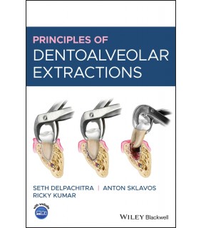 John Wiley & Sons Principles of Dentoalveolar Extractions