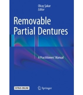 Springer ebook Removable Partial Dentures