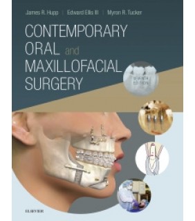 C V Mosby ebook Contemporary Oral and Maxillofacial Surgery