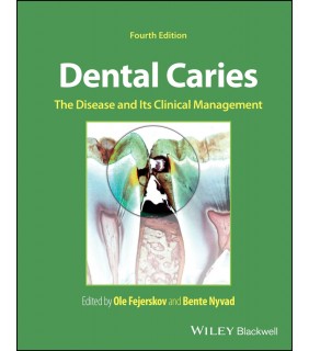 John Wiley & Sons Dental Caries 4E: The Disease and its Clinical Management