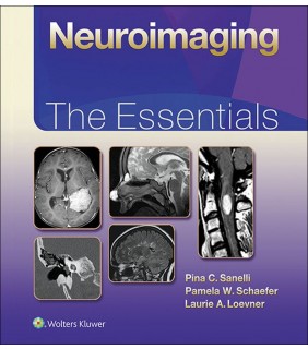 Lippincott Williams & Wilkins USA ebook Neuroimaging: The Essentials