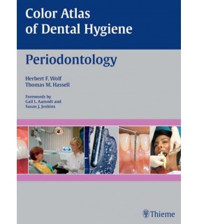 Thieme Medical Publishers ebook Color Atlas of Dental Hygiene: Periodontology