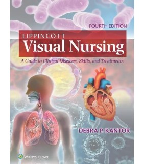 Lippincott Williams & Wilkins USA Lippincott Visual Nursing: A Guide to Clinical Diseases, Ski