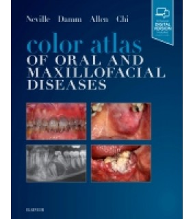 Elsevier Color Atlas of Oral and Maxillofacial Diseases