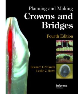 CRC Press Planning and Making Crowns and Bridges 4E
