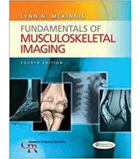 ebook RENTAL 180 DAYS Fundamentals of Musculoskeletal Imagin