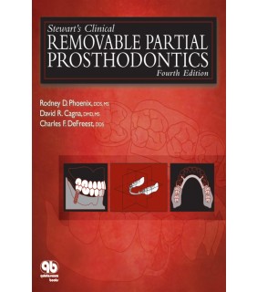 Quintessence ebook Stewart’s Clinical Removable Partial Prosthodontics 4E