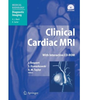 Springer ebook Clinical Cardiac MRI